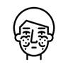 Lupus